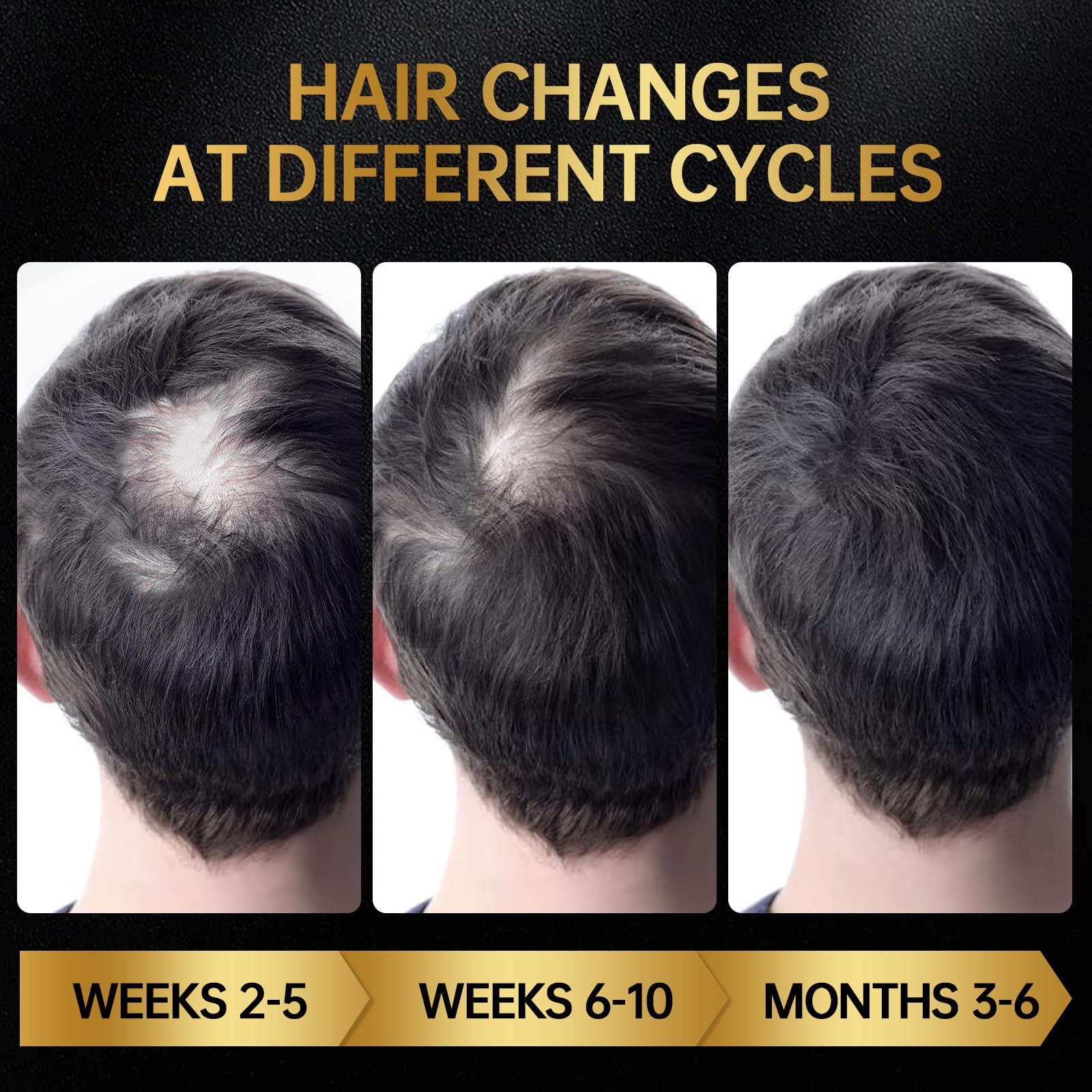 OCSINL Minoxidil cabello mejorado espeso con mayor densidad