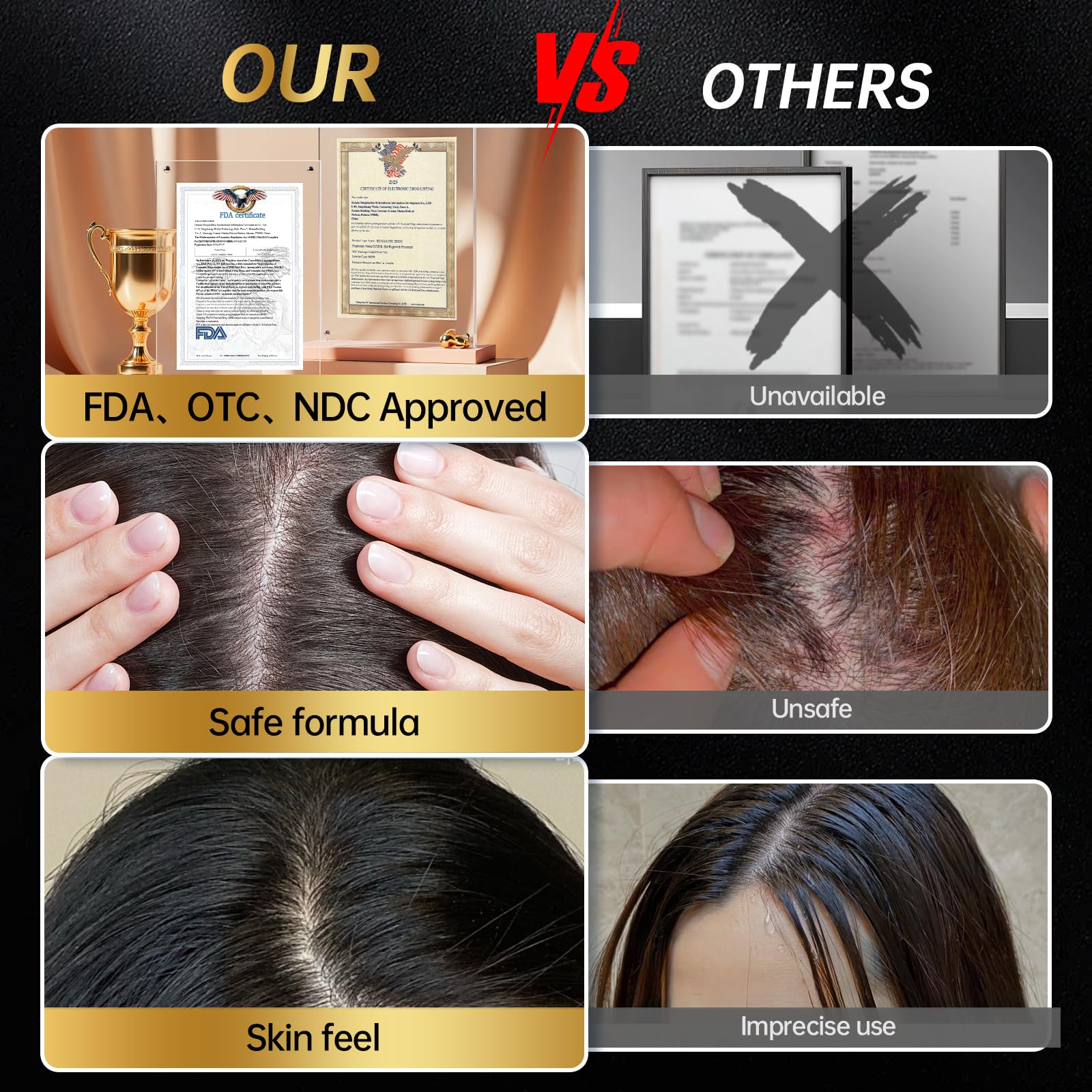OCSINL Minoxidil envase 60ml ideal para casa o viaje