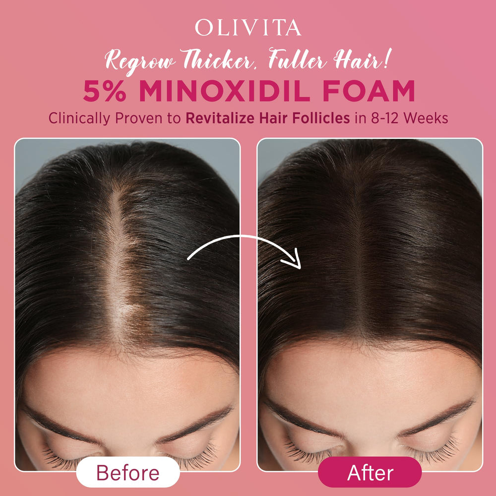 OLIVITA contiene biotina, cafeína y romero para cuidar suavemente el cuero cabelludo.