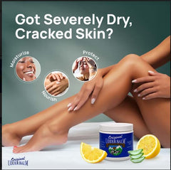 Original Udder Balm para manos y codos con humectación