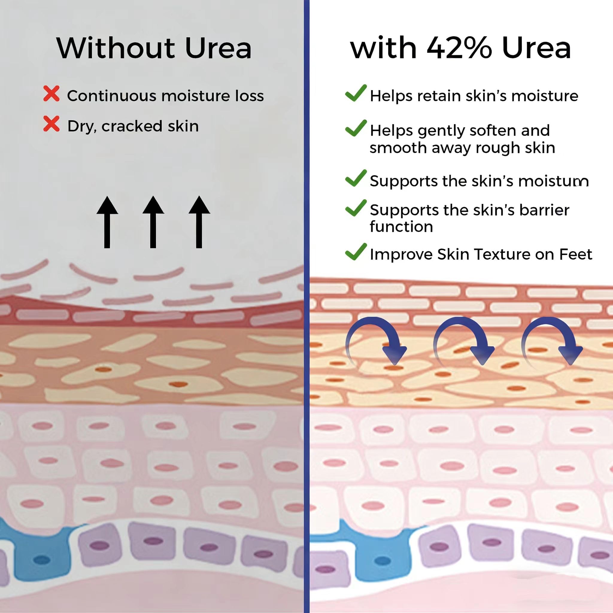 OUKEYA crema de urea con ácido salicílico, uso diario para piel seca.