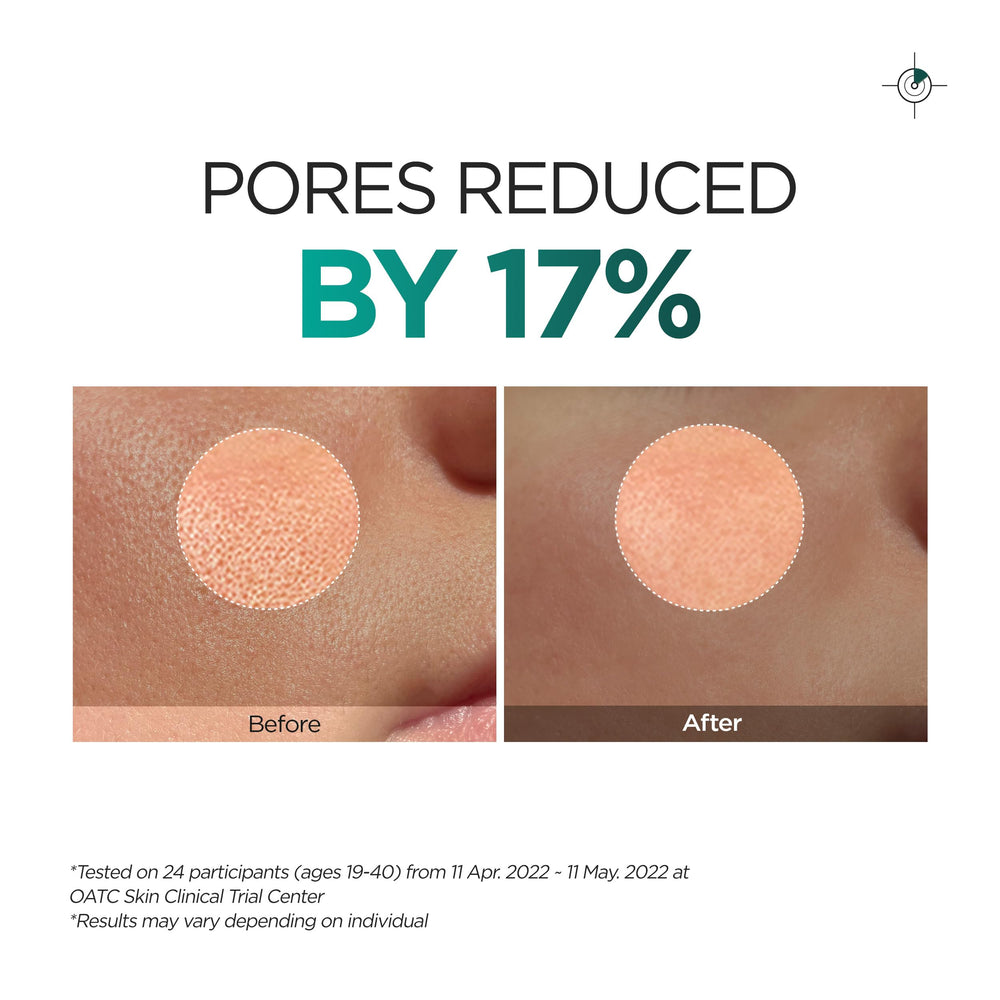Lado relieve exfoliante de P.CALM para refinar textura sin irritación.