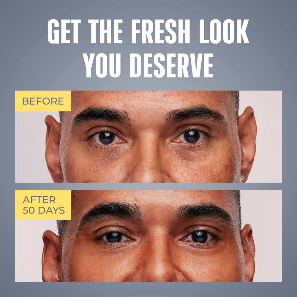 PENEBELLA crema ojos sin fragancia, adecuada para piel sensible.