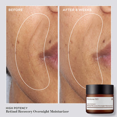 Perricone MD mezcla triple de retinol para renovación de la piel