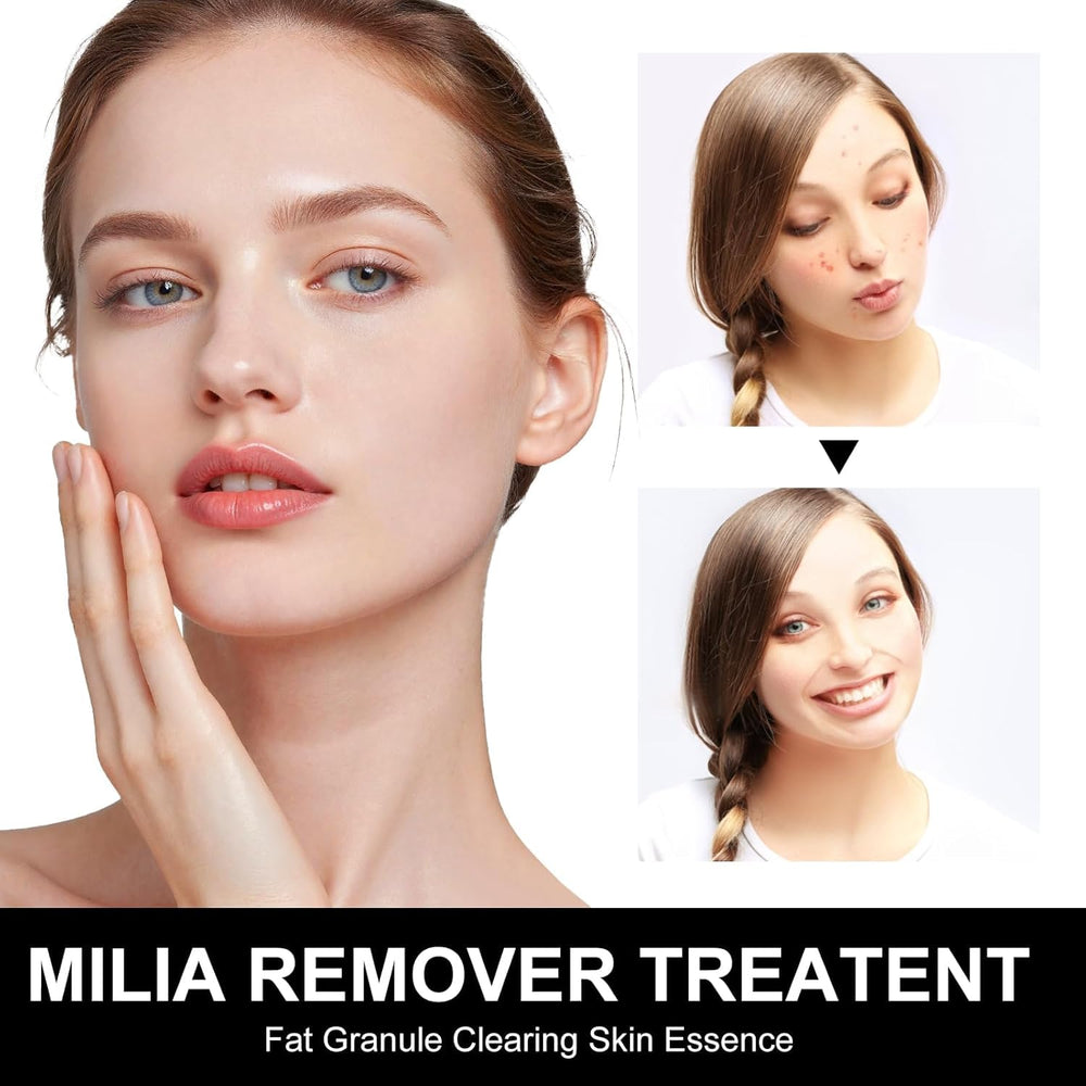 Platicat Milia Remover: textura-ligera-no-grasa, absorción rápida.