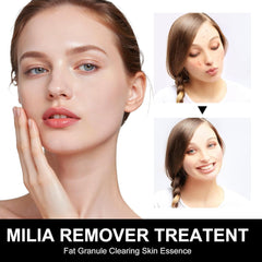 Platicat Milia Remover: textura-ligera-no-grasa, absorción rápida.