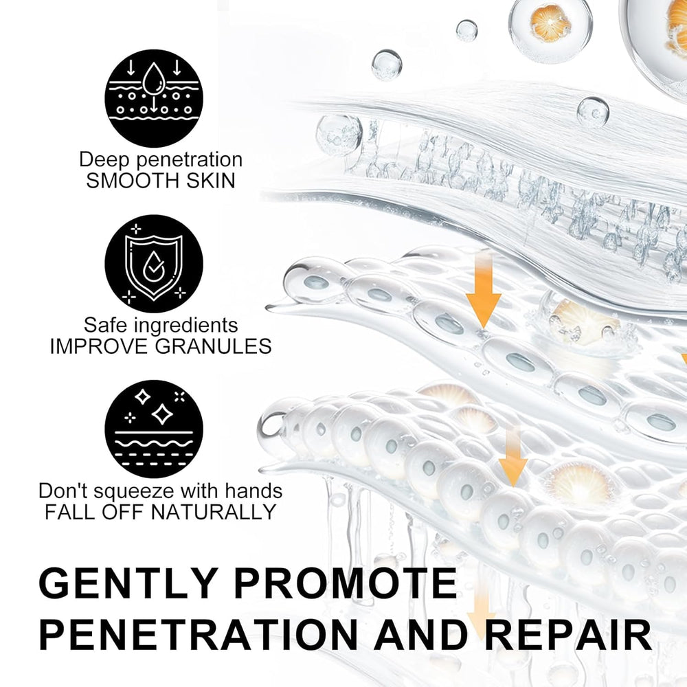 Platicat Milia Remover: tratamiento-multiarea para-mancha, aborda imperfecciones.