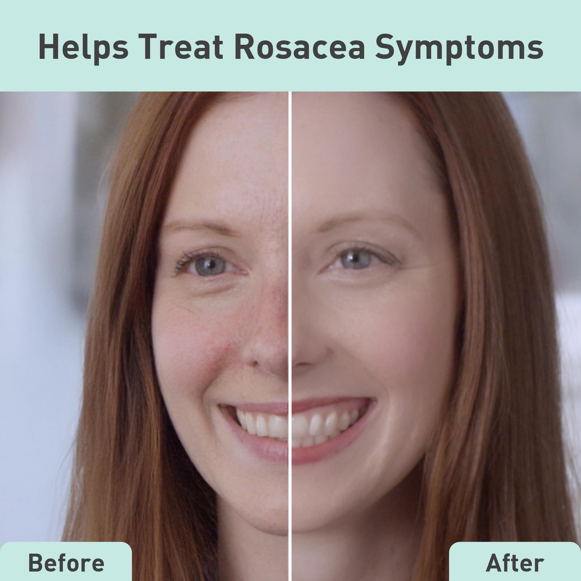 Extracto de pepino en PROcure Rosacare hidrogel aporta frescura y alivio