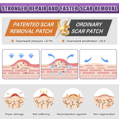 Psecici banda silicona cicatriz postoperatoria: apoyo suave y transpirable.