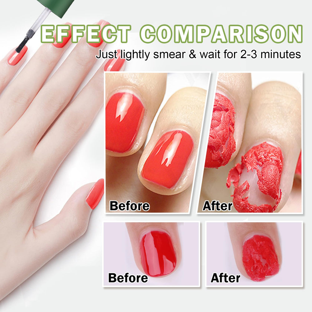 QIUFSSE Removedor Gel con penetración rápida suaviza esmalte.