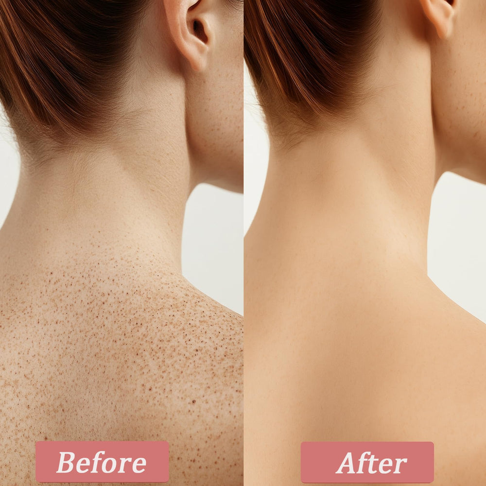 Qiuumey crema exfoliante piernas: deja la piel más suave y uniforme