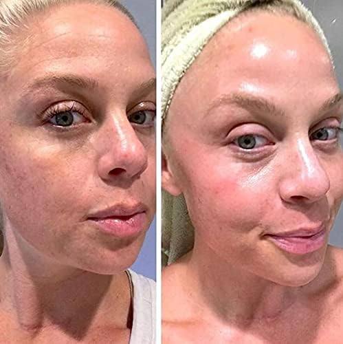 Retinol Gel 0,1% – textura ligera en primer plano para piel suave.