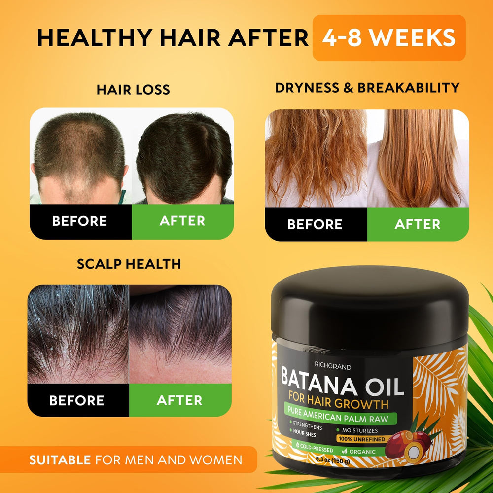 RICHGRAND Aceite de Batana textura cruda, nutrición natural para cabello y piel.