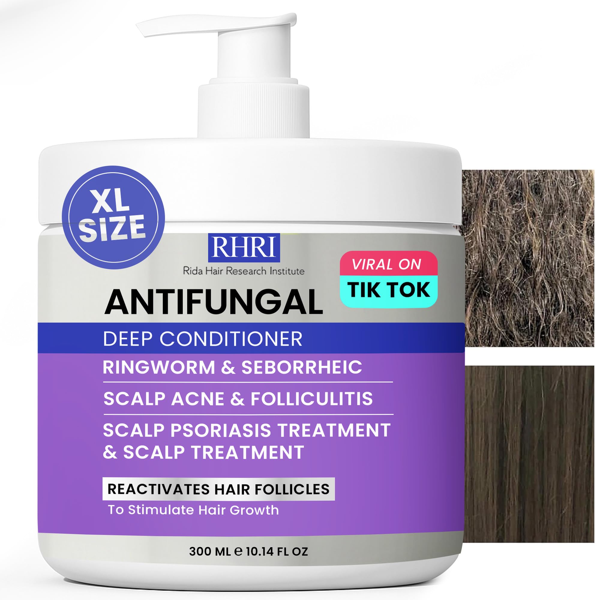 Rida Hair Research Institute muestra la botella antifúngica para un cuero cabelludo más saludable