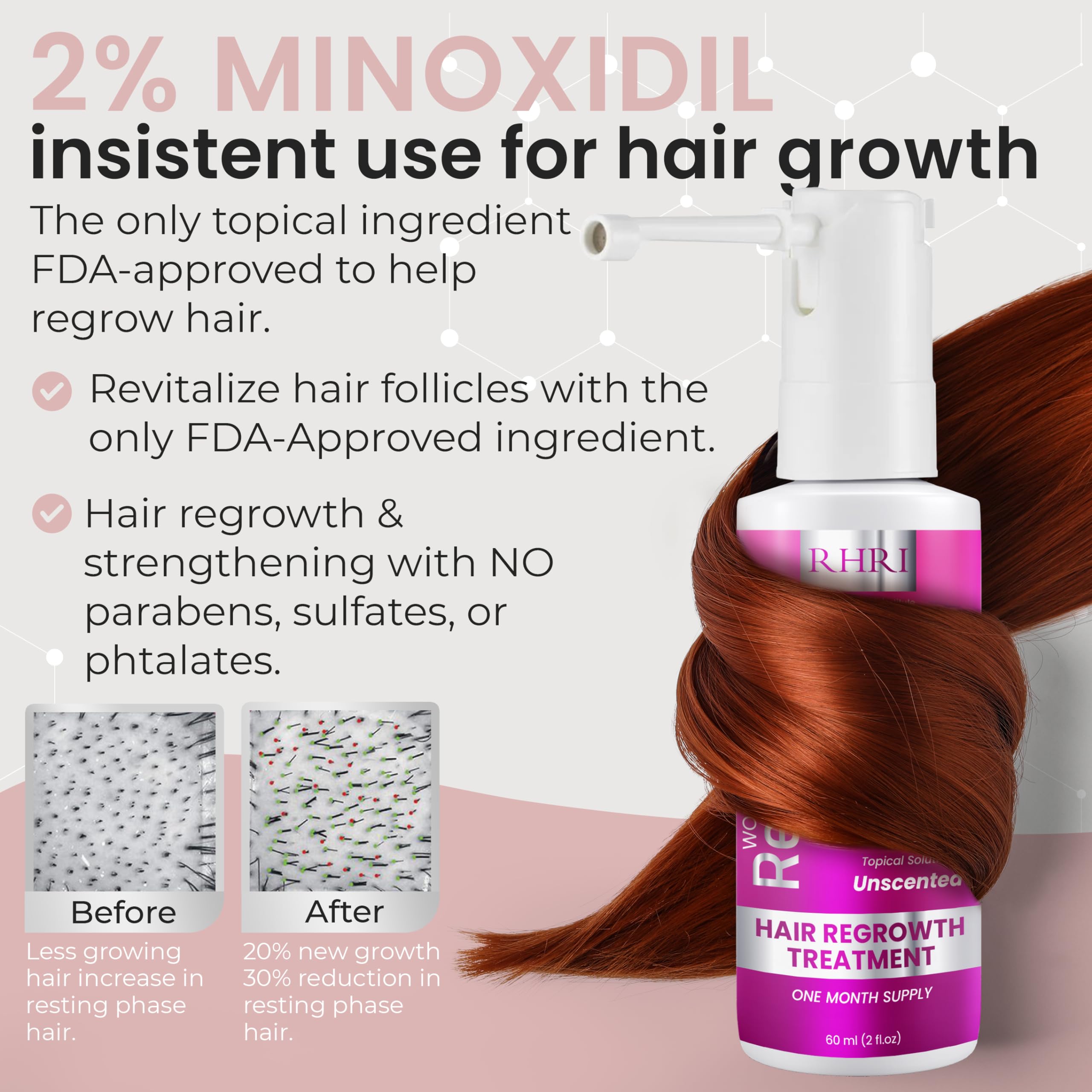 Rida Hair Research Institute aplicación en cuero cabelludo, cabello más denso posible con Minoxidil
