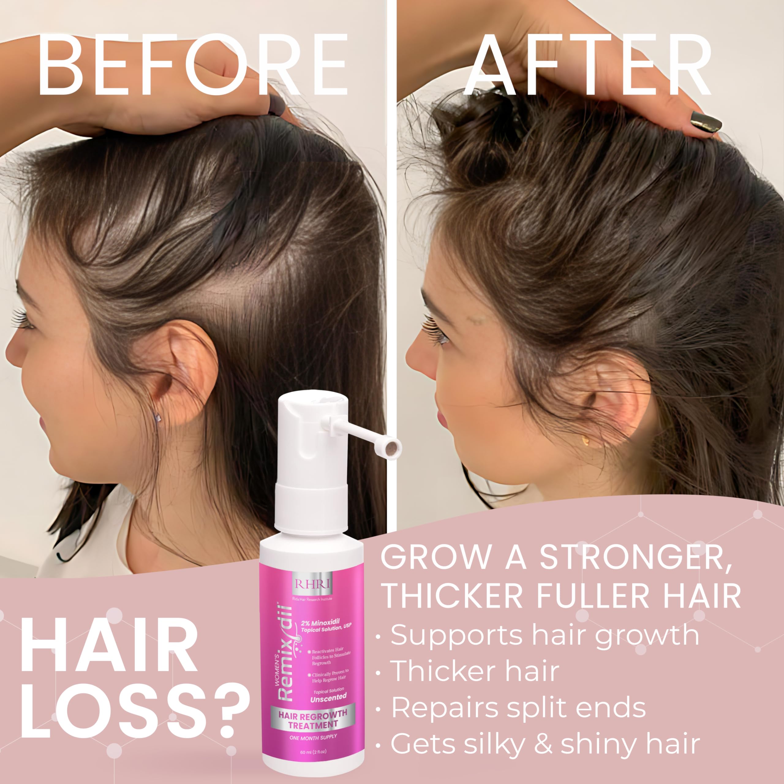 Rida Hair Research Institute cabello más denso con uso regular, solución tópica para adelgazamiento