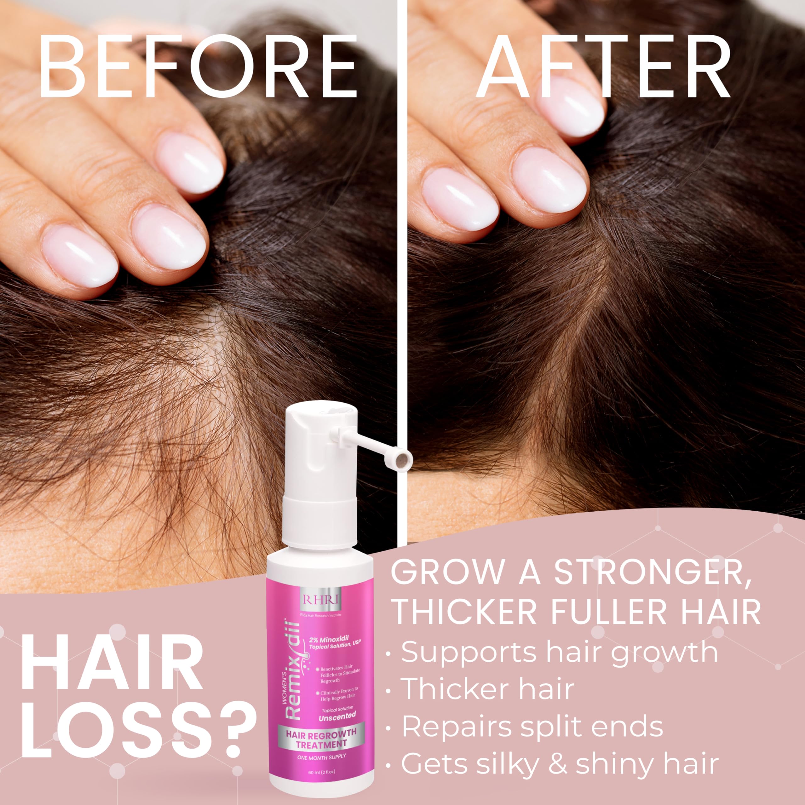 Rida Hair Research Institute diseño de envase, fácil manejo diario de Minoxidil para mujeres