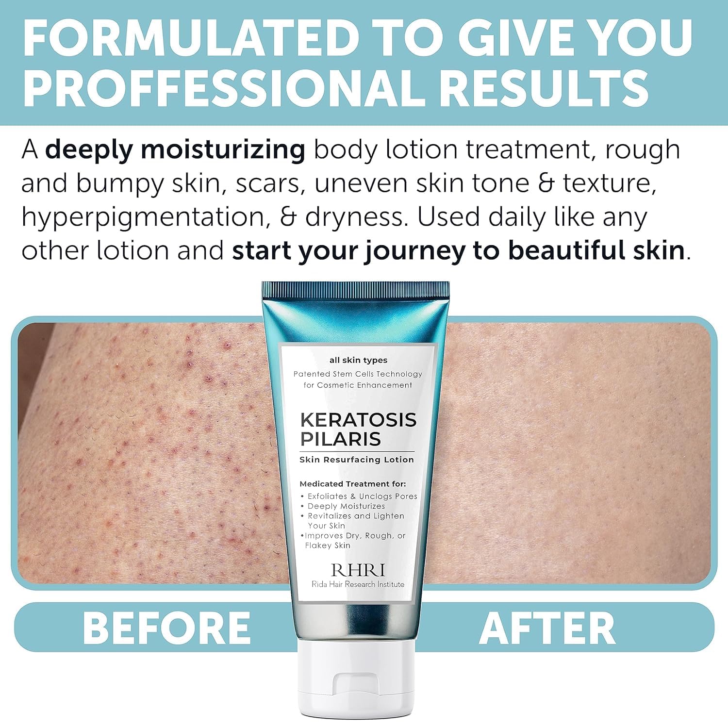 Rida: exfoliación suave para mejorar la textura de la piel.