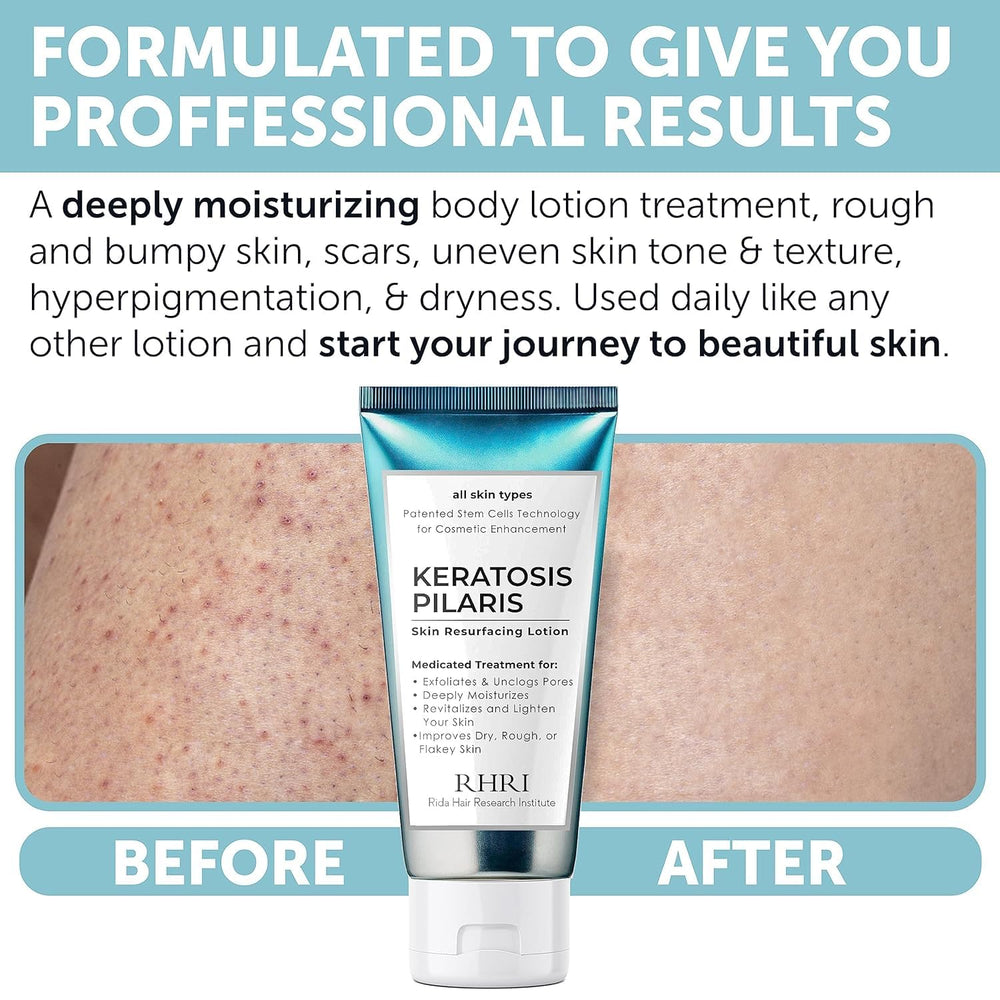 Rida: exfoliación suave para mejorar la textura de la piel.