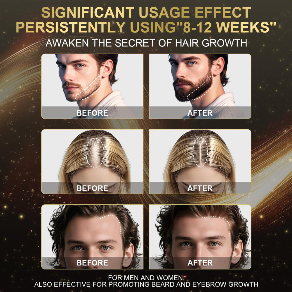 Sidinox espuma Minoxidil, aplicación diaria fácil para cabello más denso.