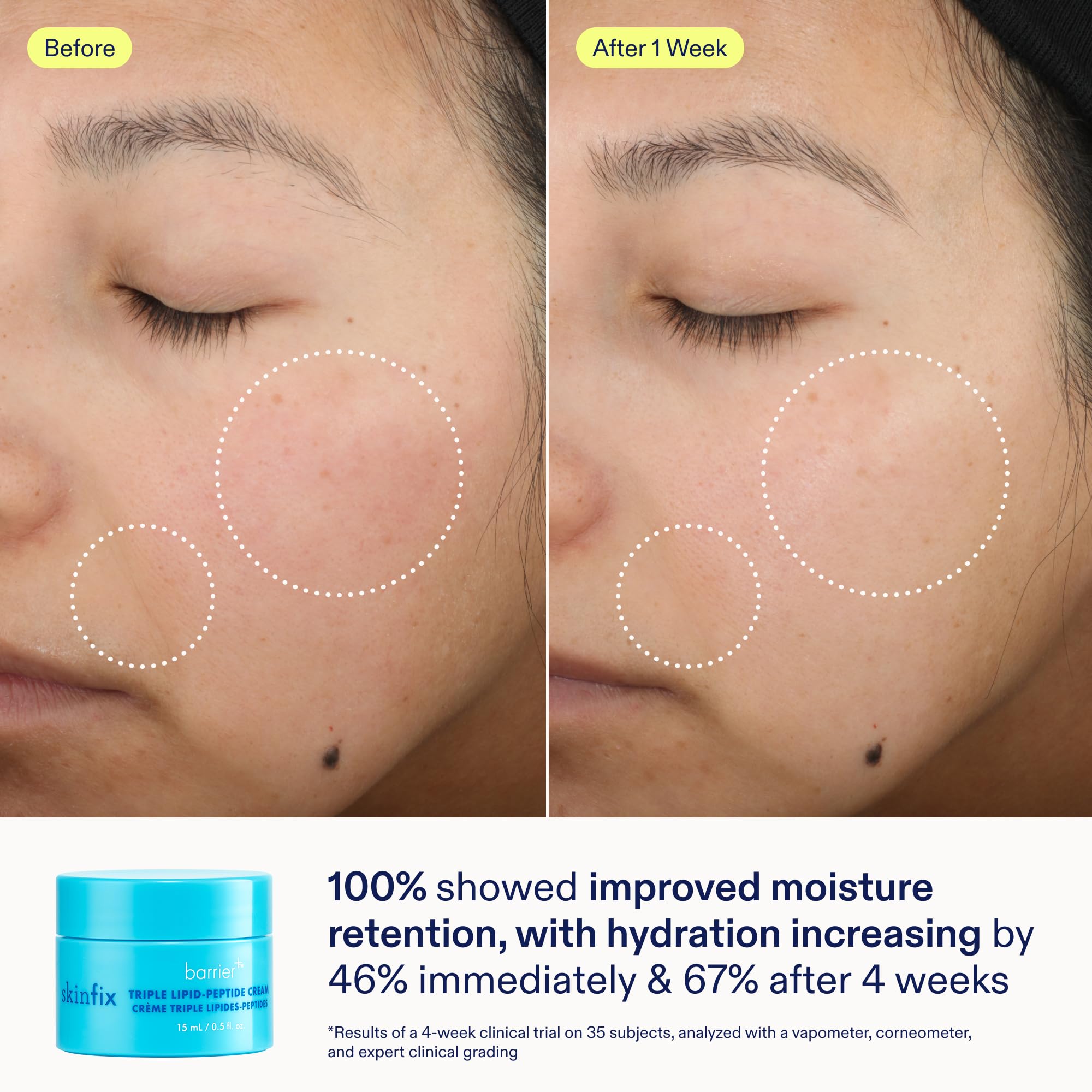 Skinfix Barrier+ resultados: piel más hidratada y glow.