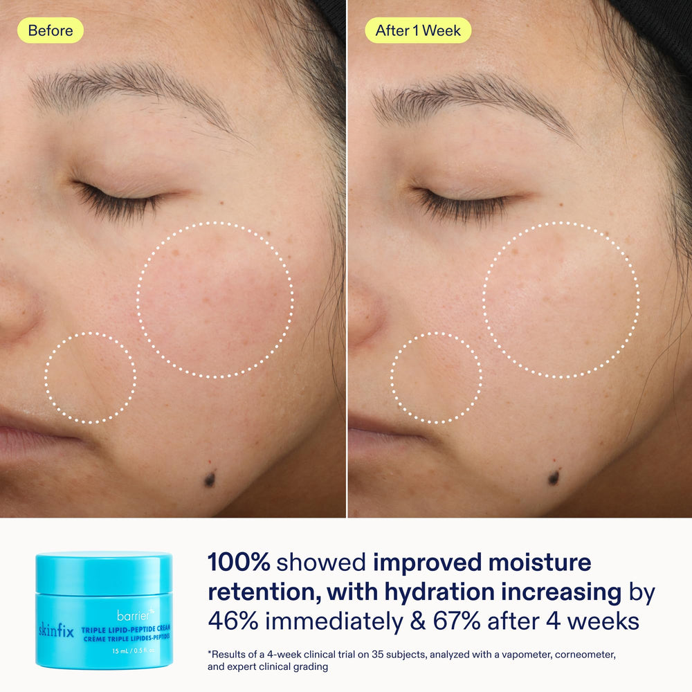 Skinfix Barrier+ resultados: piel más hidratada y glow.