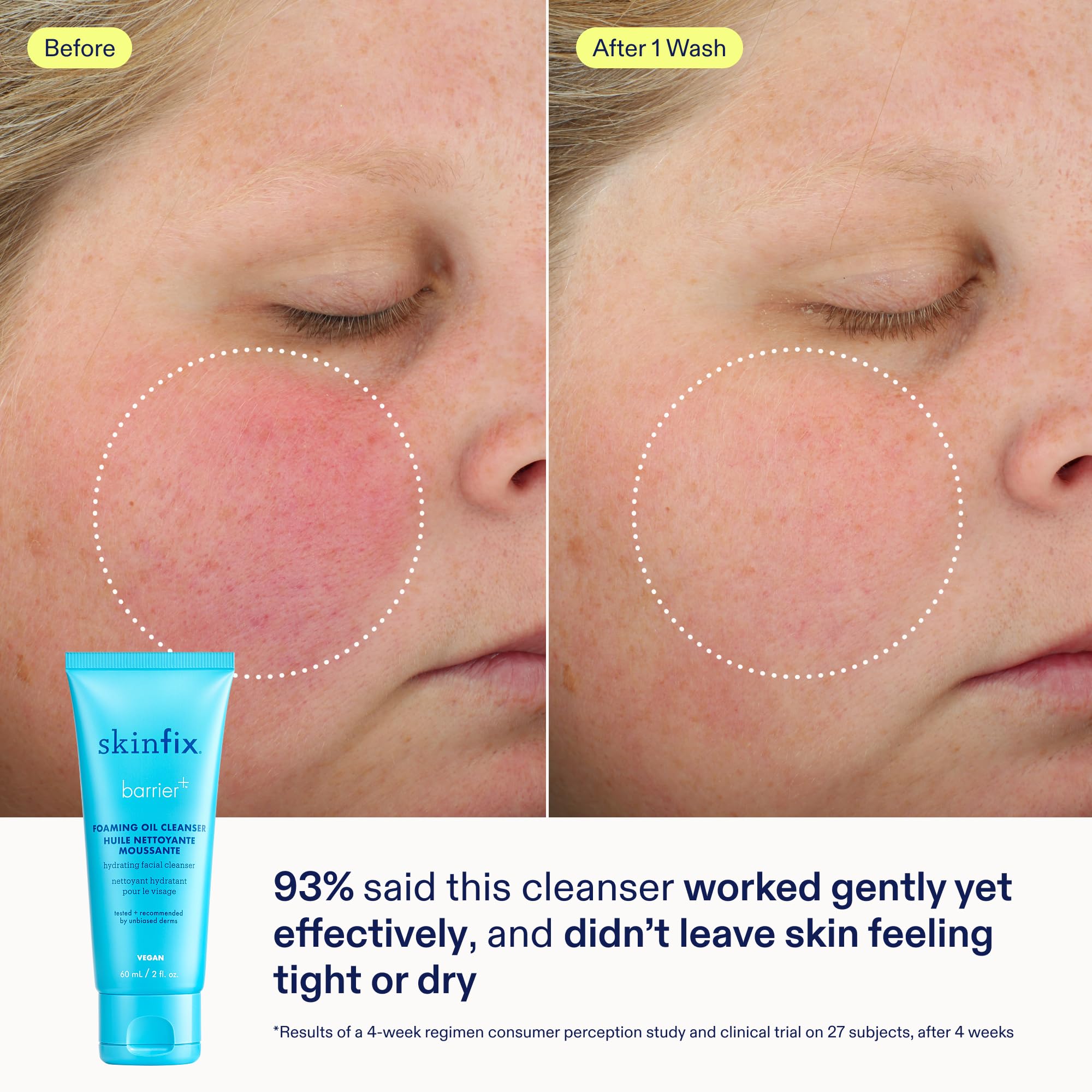 Skinfix mini limpiador espumoso, espuma suave que deja la piel fresca.