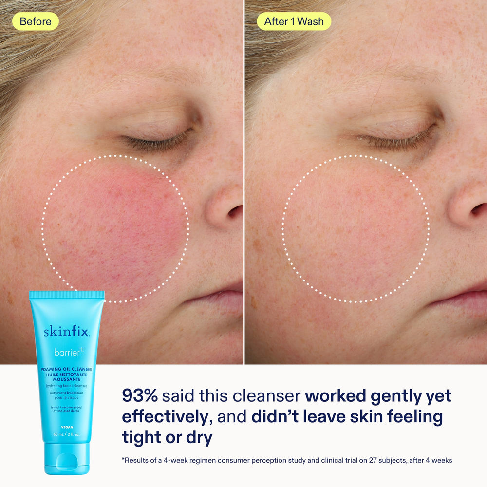 Skinfix mini limpiador espumoso, espuma suave que deja la piel fresca.