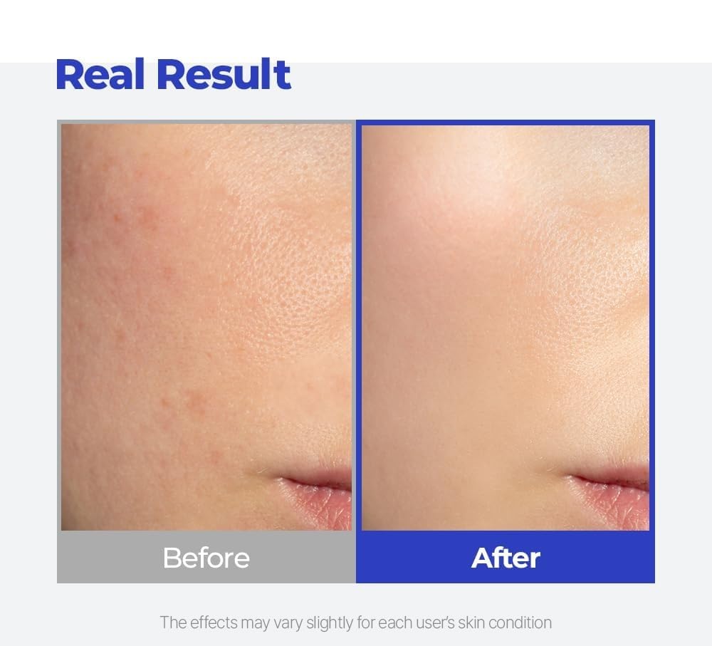 Fórmula hidratante suave de SKINSINS para piel sensible, apta para maquillaje.