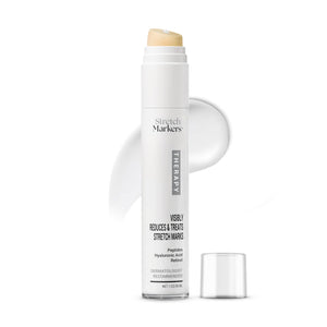 StretchMarkers Terapia crema para estrías; envase de 30 ml, hidrata y apoya la elasticidad de la piel.