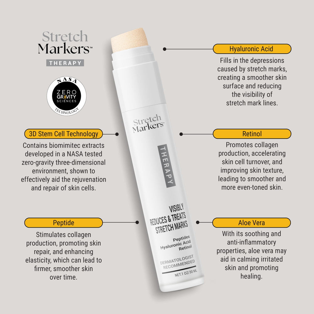StretchMarkers Terapia crema; textura rica en la palma, sensación suave que hidrata y nutre la piel.