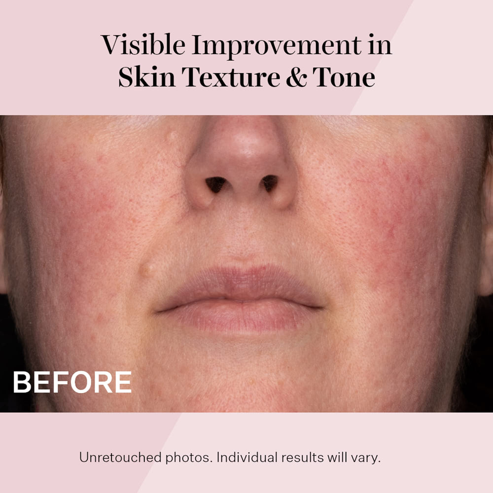 StriVectin Advanced Retinol Daily Repair SPF30 ofrece protección diaria