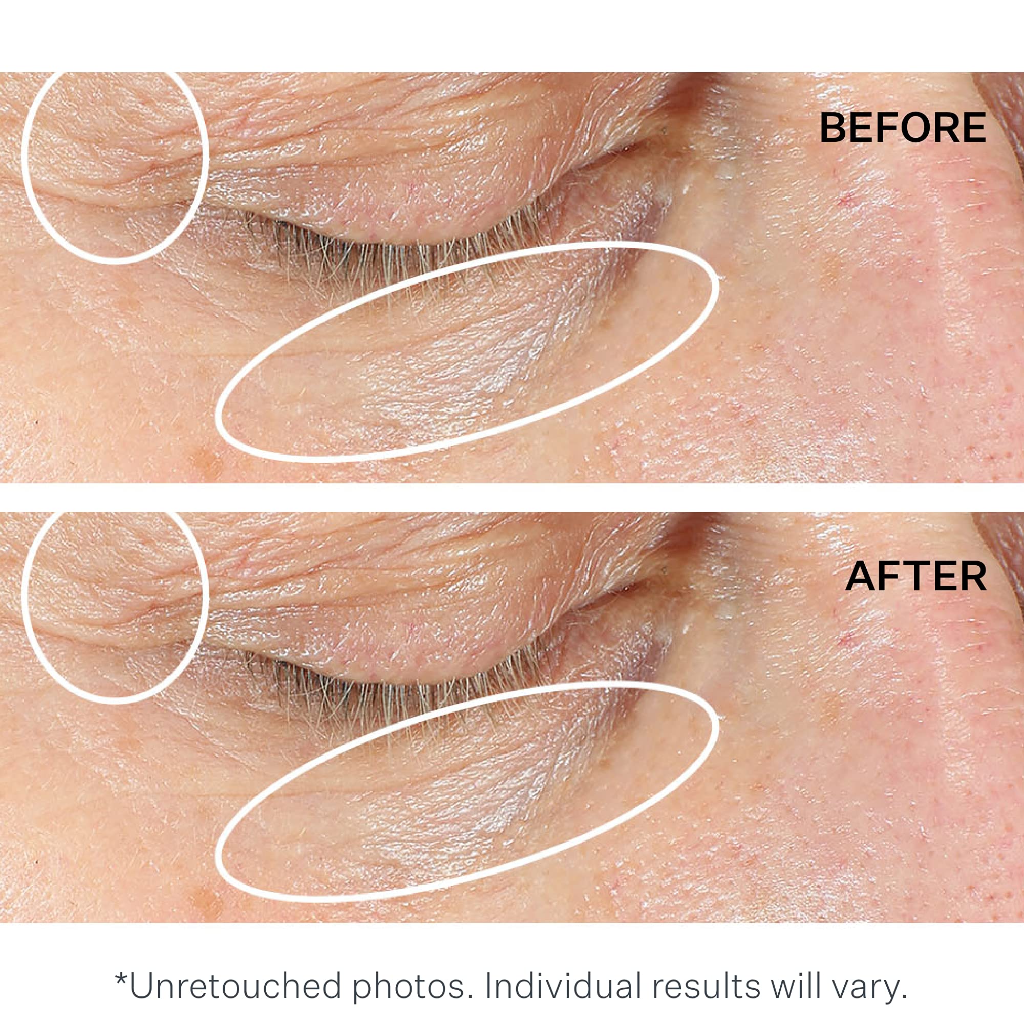 strivectin combate bolsas y ojeras, mirada más clara.