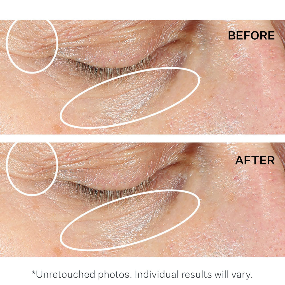strivectin combate bolsas y ojeras, mirada más clara.