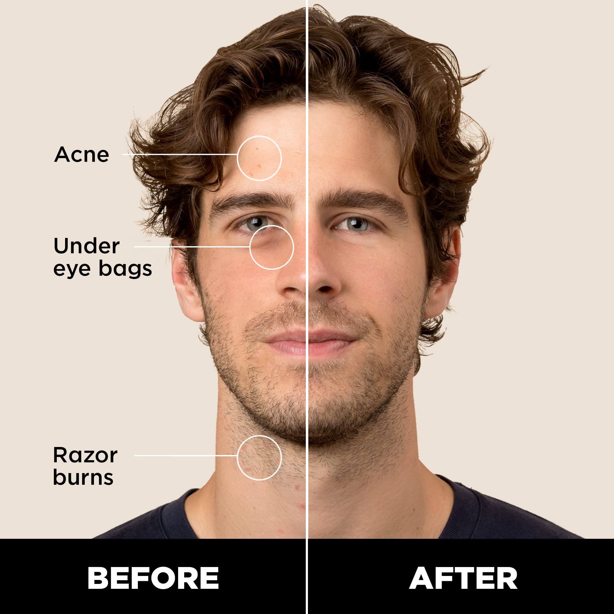 Stryx corrector para caballero, tono caoba mediano, oculta acné sin dejar residuo.