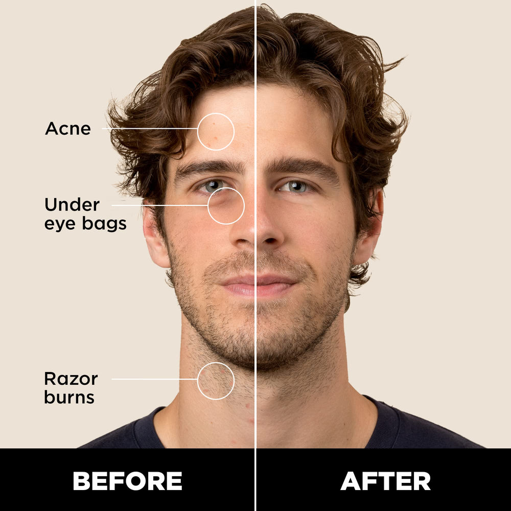 Stryx corrector para caballero, tono caoba mediano, oculta acné sin dejar residuo.