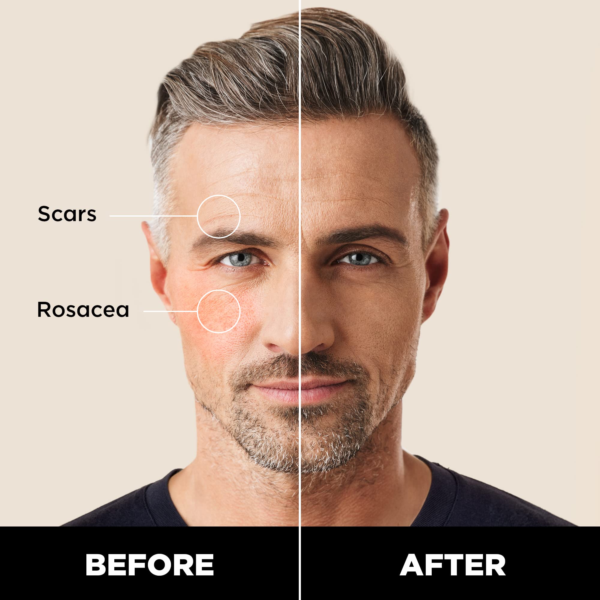 Stryx corrector para caballero, tono caoba mediano, oculta acné y suaviza tono.
