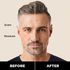 Stryx corrector para caballero, tono caoba mediano, oculta acné y suaviza tono.