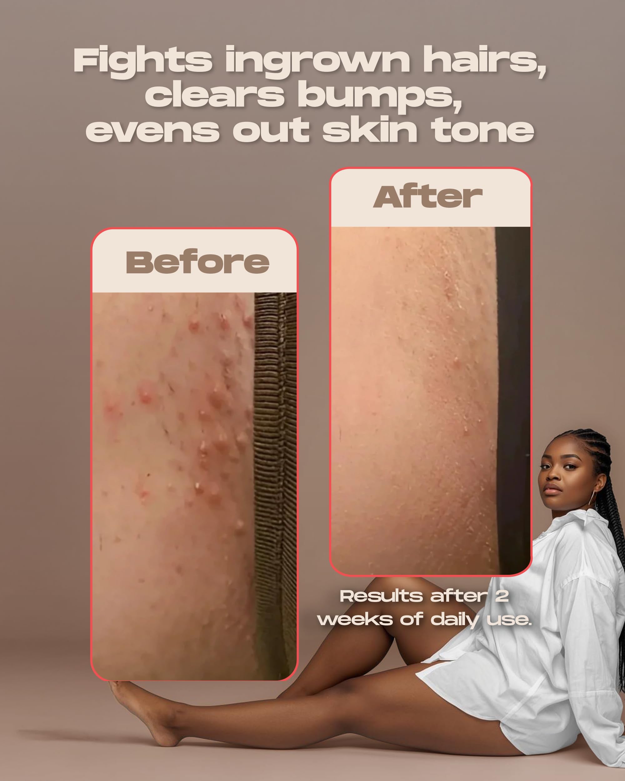 Sugardoh Ingrown Magic Wand, uso posdepilación para reducir irritación.