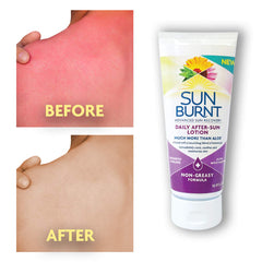 Sunburnt loción con coco y pepino para hidratación diaria
