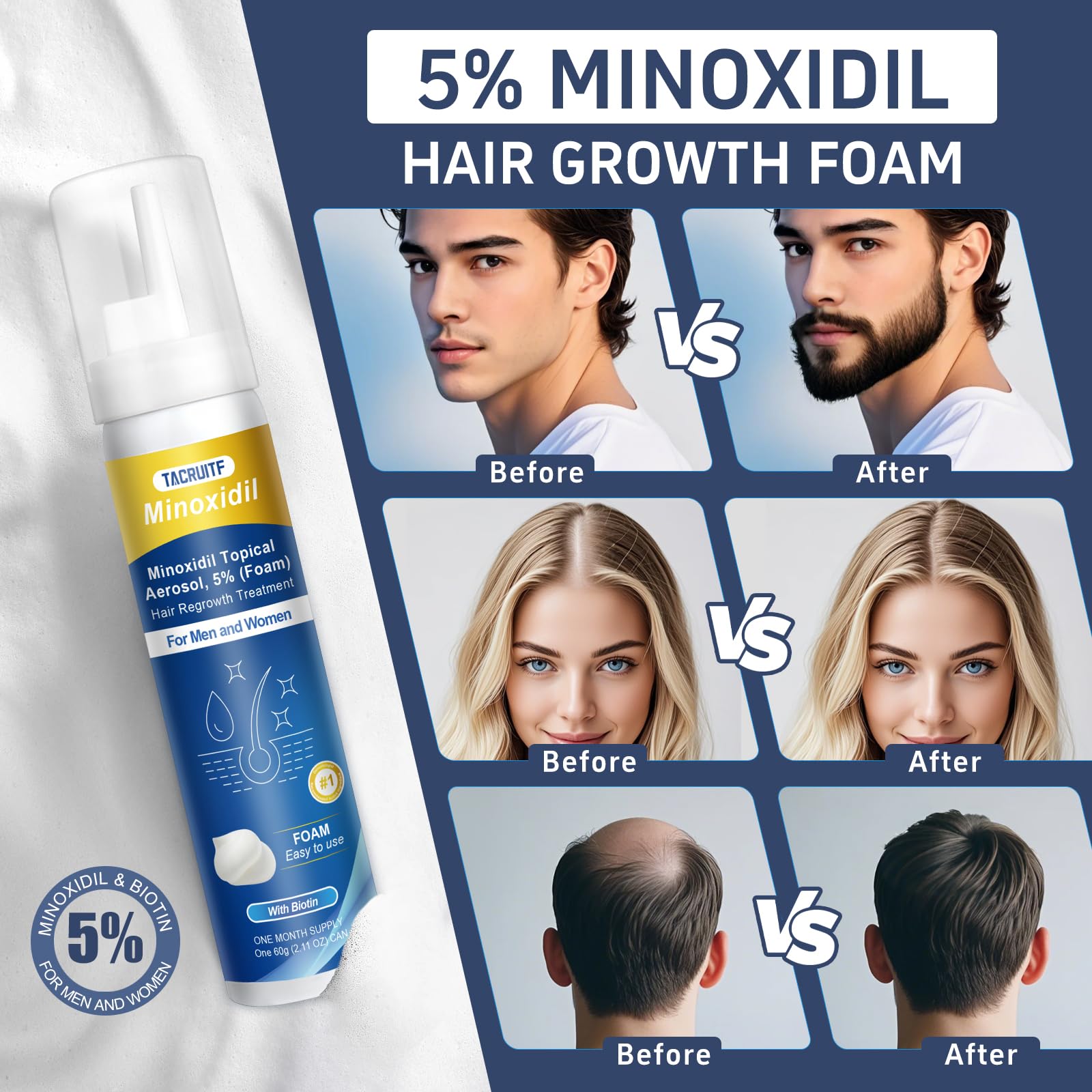 Tacruitf Minoxidil Espuma, masaje suave para activar folículos capilares.