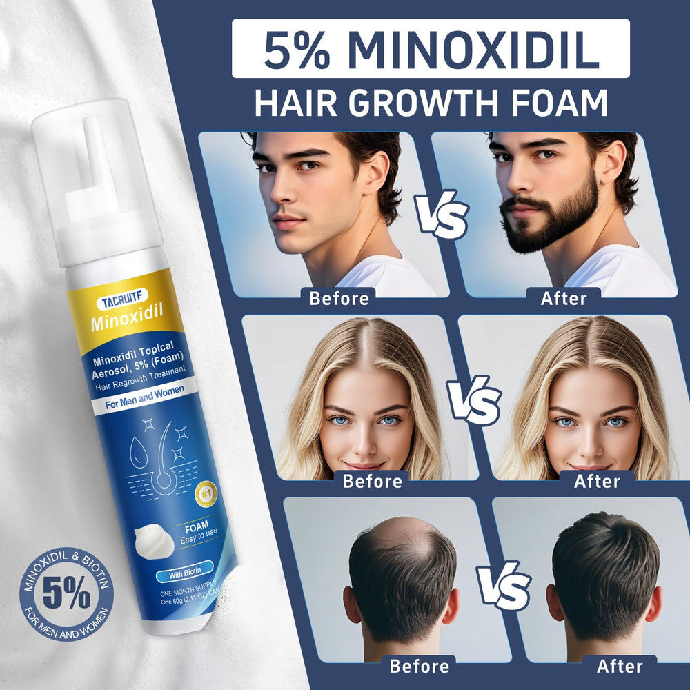 Tacruitf Minoxidil Espuma, masaje suave para activar folículos capilares.
