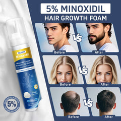Tacruitf Minoxidil Espuma, masaje suave para activar folículos capilares.
