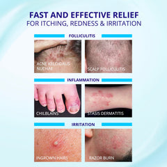 TAGRID Crema Foliculitis, alivio inmediato y confort de piel tras uso breve