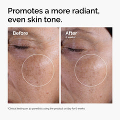 The Ordinary Glycolic Acid 7% Exfoliating Toner, dispensador, promueve piel más luminosa con uso diario.