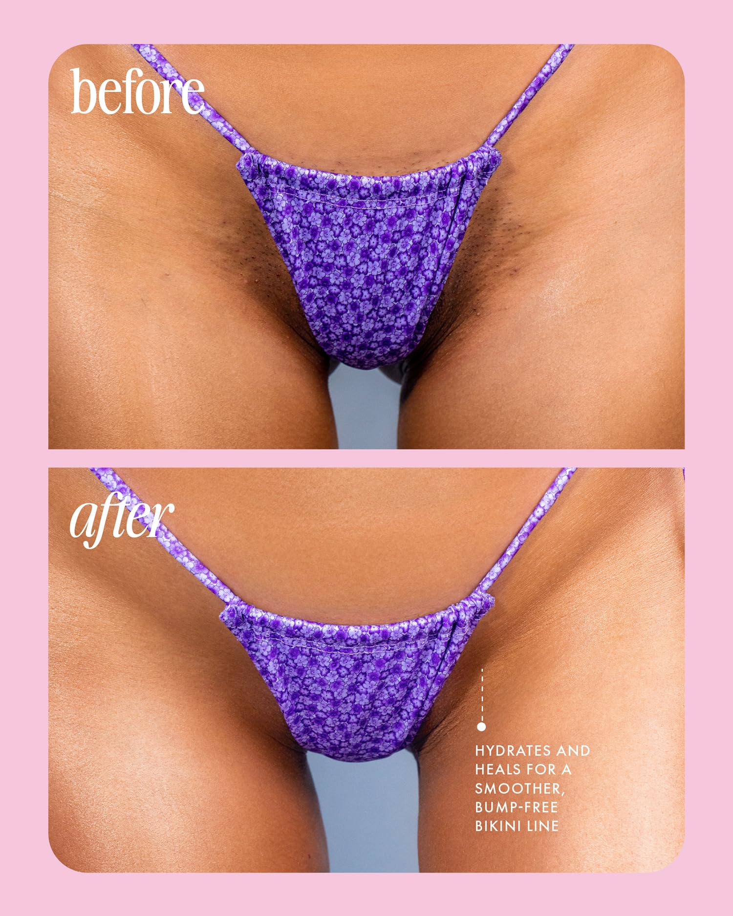 Truly Cooka Concentrate, ideal para la zona bikini.
