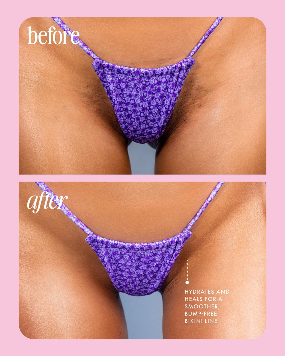 Truly Cooka Concentrate, ideal para la zona bikini.