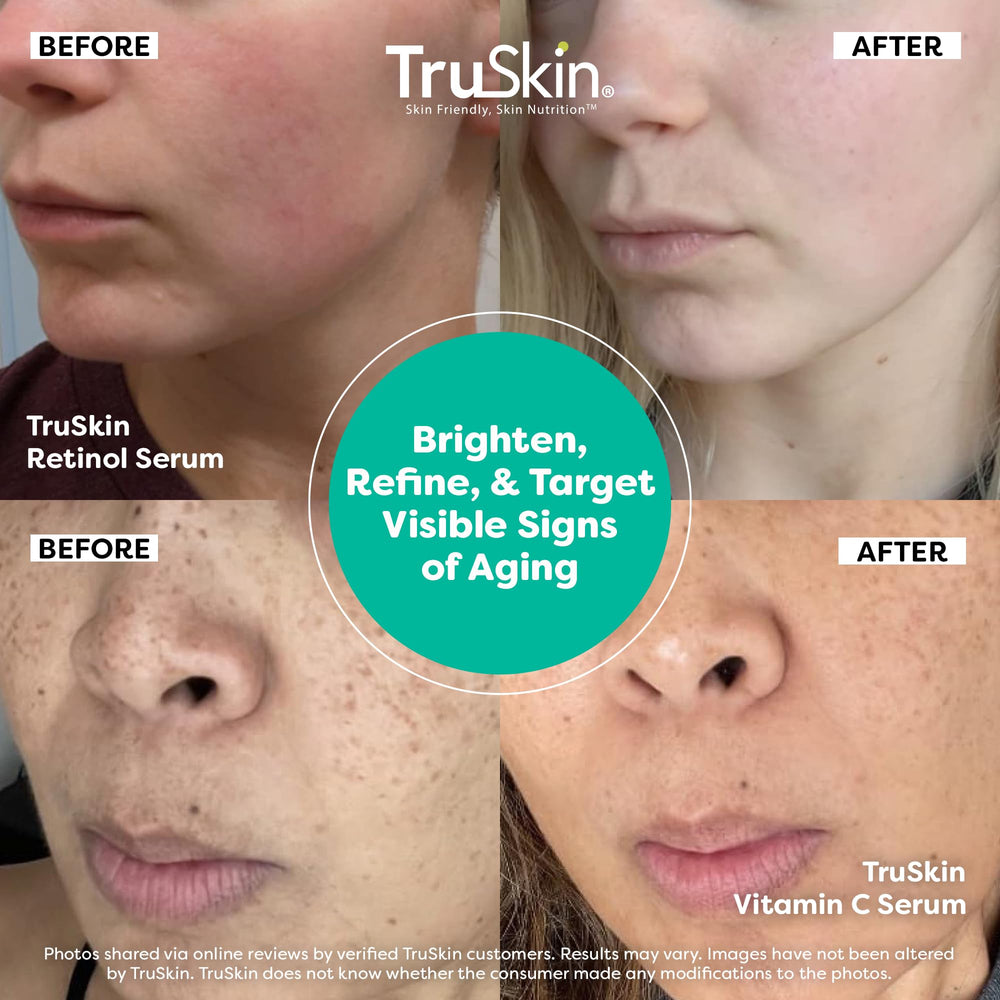 TruSkin serum Retinol, aplicación de noche para renovación suave.