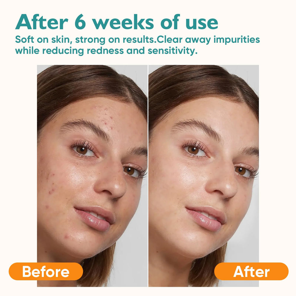 UNIMADE cuida piel sensible con textura suave sin irritación.