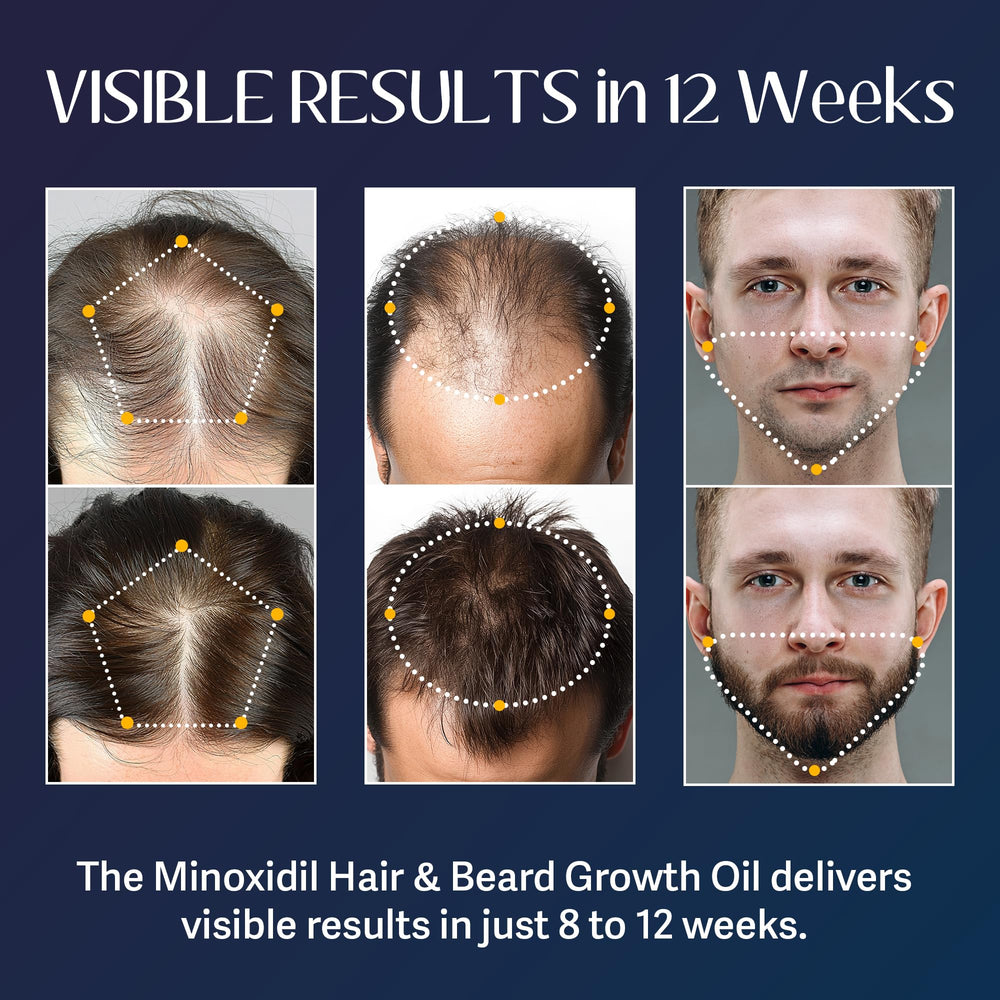 Venanoci cabello y barba más densos con uso continuo.